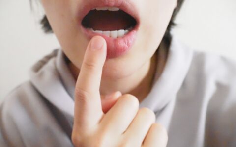 差し歯が繰り返し取れる原因と再発防止｜長持ちする治療の選び方