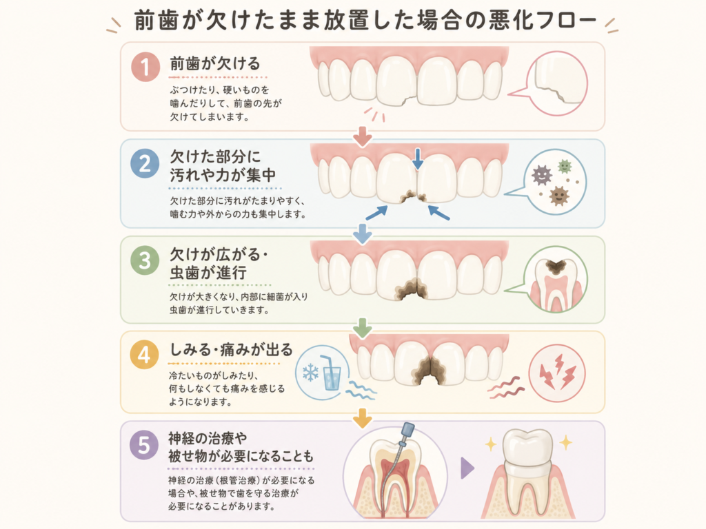 前歯が欠けたまま放置した場合の悪化フローを示した図解