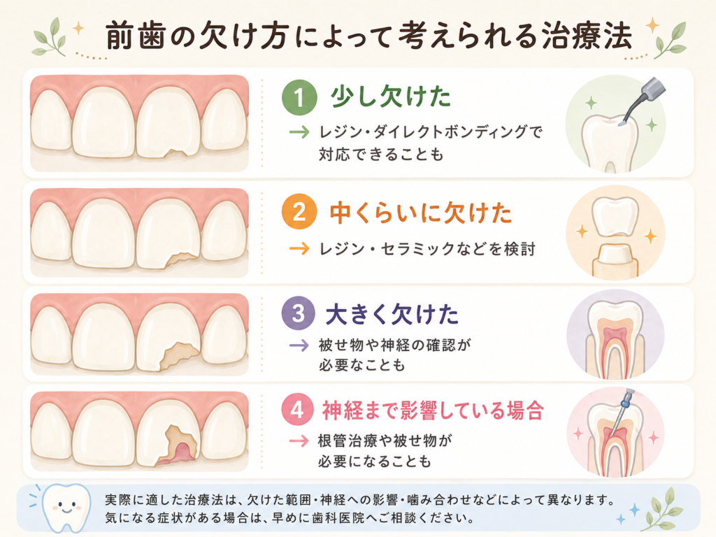 前歯の欠け方によって考えられる治療法を示した図解